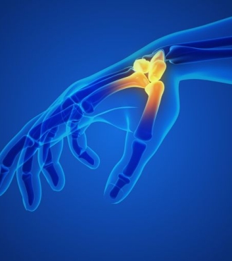 Σύνδρομο καρπιαίου σωλήνα